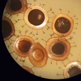 picture of statoblasts